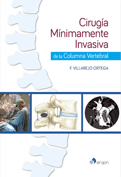 Cirugía Mínimamente Invasiva de la Columna Vertebral