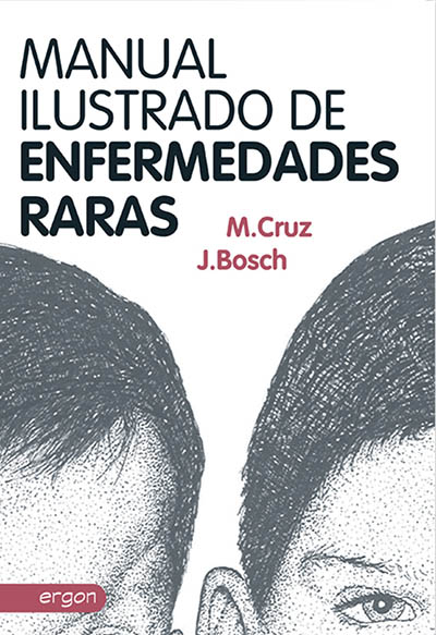Manual Ilustrado de Enfermedades Raras