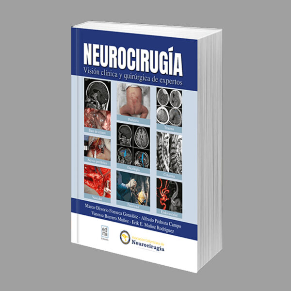 Neurocirugía | Visión Clínica y quirúrgica de expertos